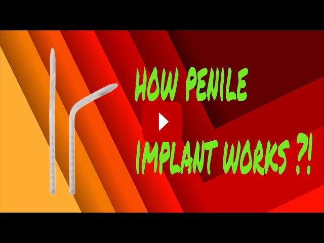 How Penile Implants Work