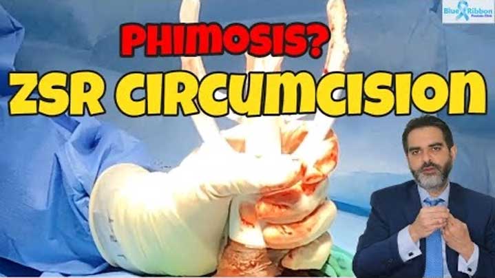 Best Treatment For Phimosis  Phimosis Laser Treatment 